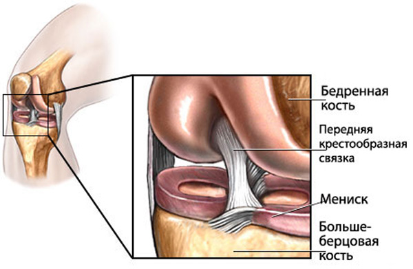 Повреждение менисков левого коленного сустава